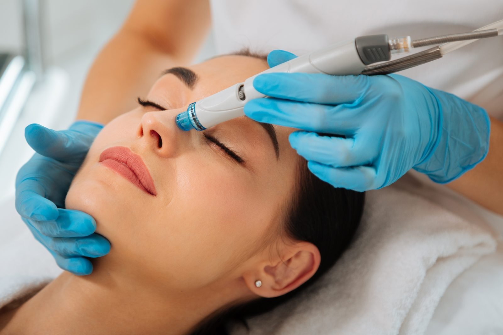 Laser Hair Removal procedure
